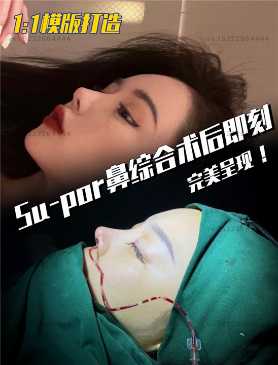 天津任静整形医生