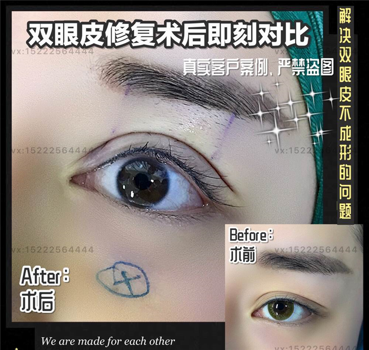 天津面部年轻化医生