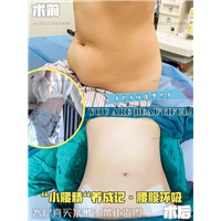 天津好的整形医生