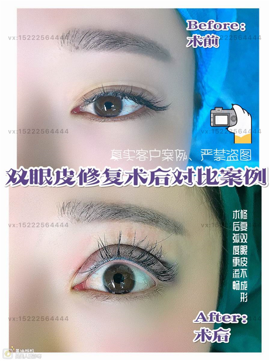 任静整形医生