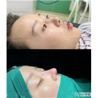 任静医生怎么样