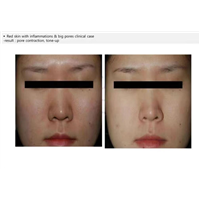 asce外泌体作用与功效有哪些呢这里有答案