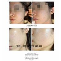 ASCE外泌体干细胞抗衰作用有哪些效果