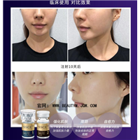为什么我们会衰老呢如何延缓衰老