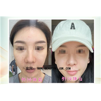 干细胞外泌体技术是什么