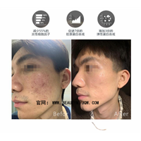 ASCEPlus外泌体是什么原产地在哪