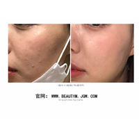 外泌体干细胞是什么作用有哪些