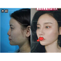 广州整形医院厉害的医生
