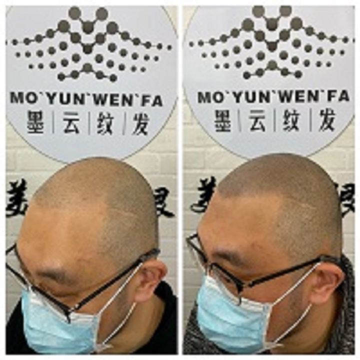 上海纹发案例
