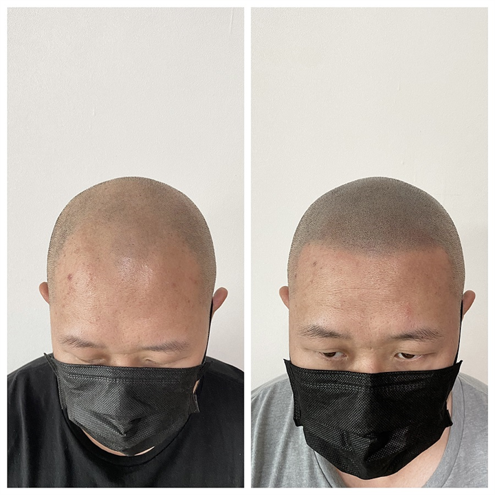 浙江纹发案例