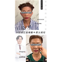 上海拉皮医生赵寅局