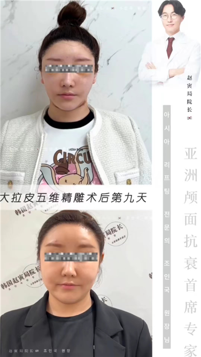 上海拉皮手术医生赵寅局
