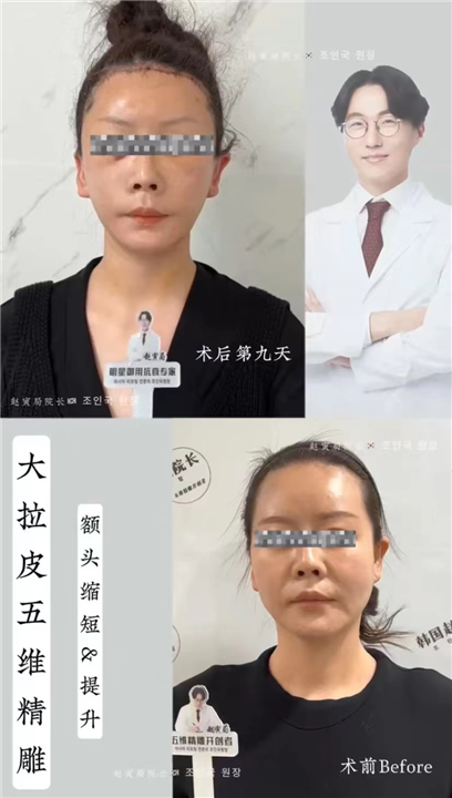 逆龄抗衰认准赵寅局院长