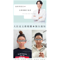 赵寅局院长五维精雕技术