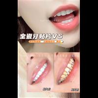 上海七星艺容术整形全瓷牙贴片美牙