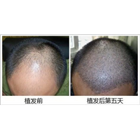 盘锦微整形培训机构|盘锦正规微整形培训班