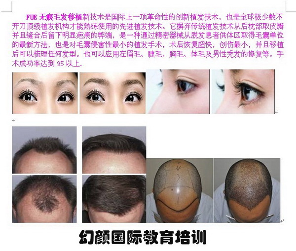 盘锦毛发移植培训