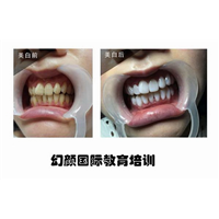 盘锦牙齿美白培训