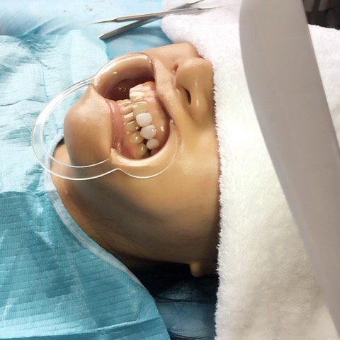 盘锦牙齿美白培训