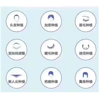 盘锦学习毛发移植哪家好