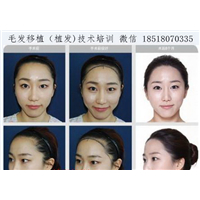 盘锦微整形培训机构|盘锦正规微整形培训班