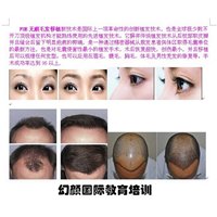 盘锦毛发移植培训