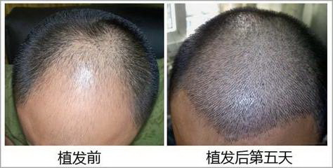 盘锦微整形培训机构|盘锦正规微整形培训班
