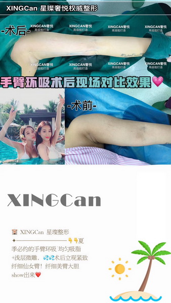 上海专业整形修复