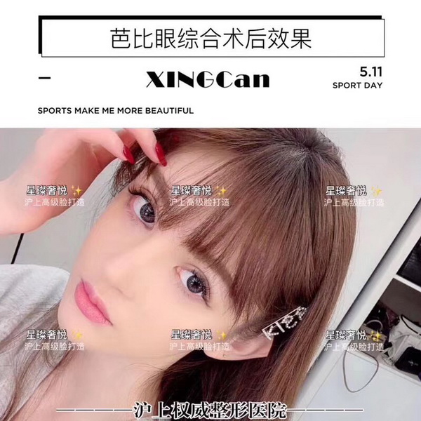 上海网红脸修复