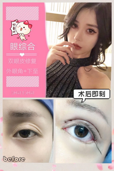沪上网红整形|沪上网红整形医院