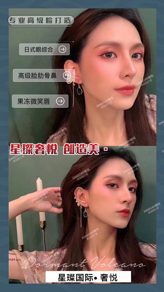 上海星璨创始人,上海鼻综合整形手术 