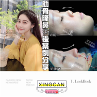 上海眼综合修复整形
