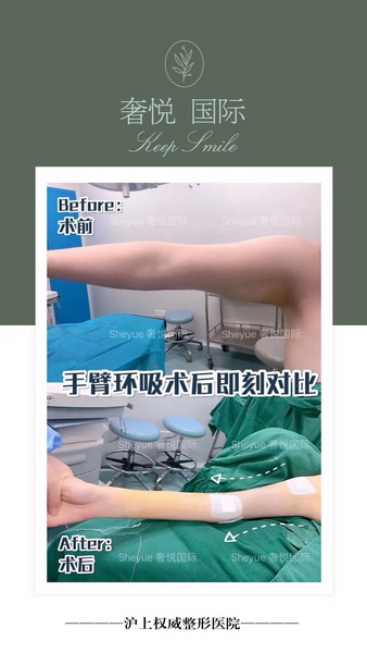 上海专业网红整形
