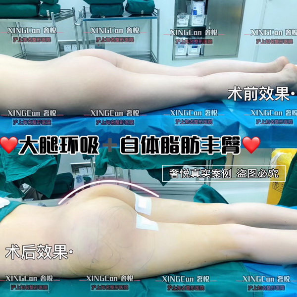 上海专业整形修复