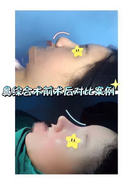 沪上网红整形医院|上海人气网红整形