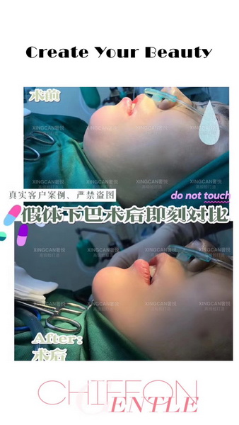 上海奢悦国际整形