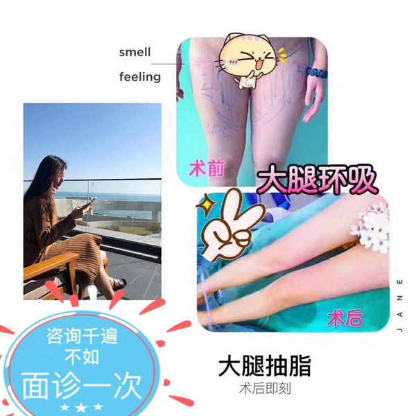 沪上网红整形|沪上网红整形医院