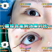 上海网红脸修复