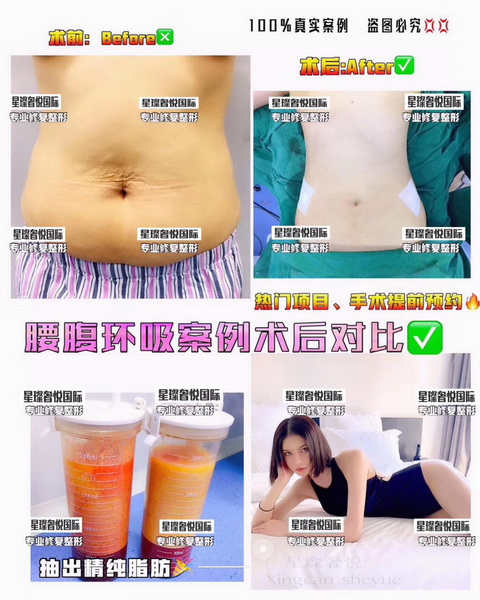上海专业整形修复
