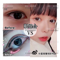 上海眼综合整形