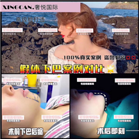 上海奢悦国际整形