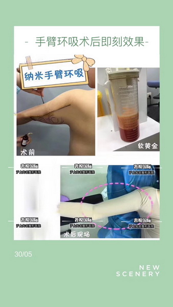 上海专业网红整形