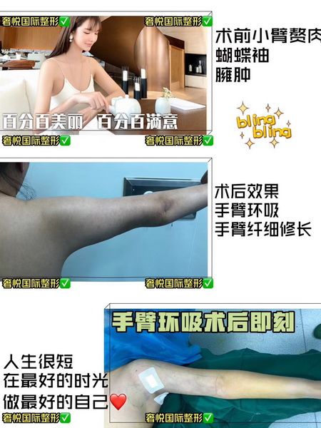 上海专业网红整形