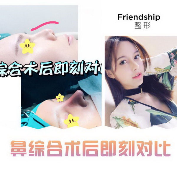 沪上网红整形医院|上海人气网红整形