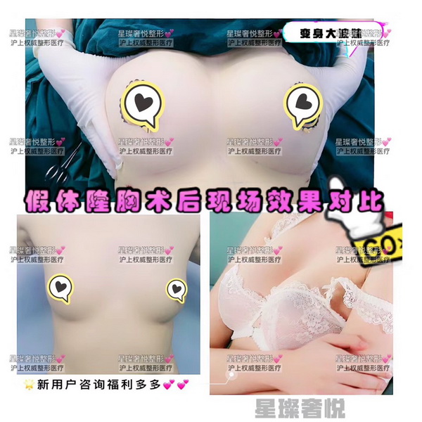上海鼻王整形