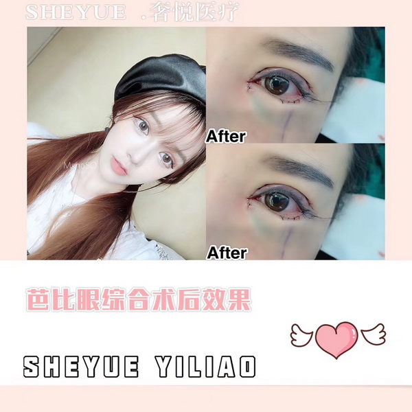 上海网红整形