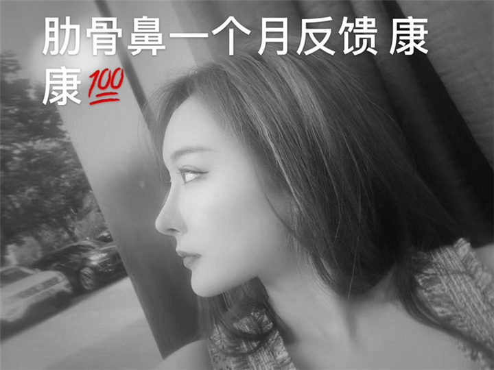 上海星璨奢悦肋骨鼻整形初次隆鼻必看 