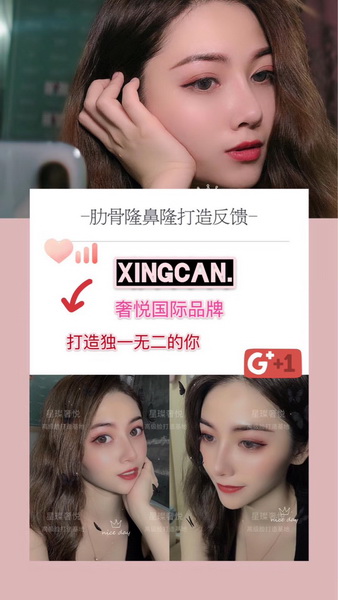 上海眼综合修复整形