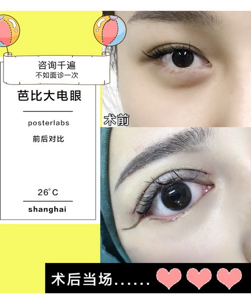 沪上网红整形|沪上网红整形医院
