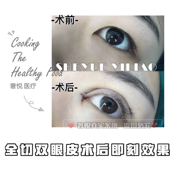 上海网红整形